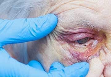 Bishopville Nursing Home Abuse Lawyers