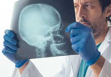 Bamberg Traumatic Brain Injury Attorney