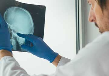 Sumter Brain Injury Attorney