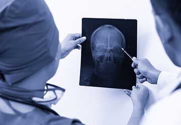 Bamberg Brain Injury Attorney
